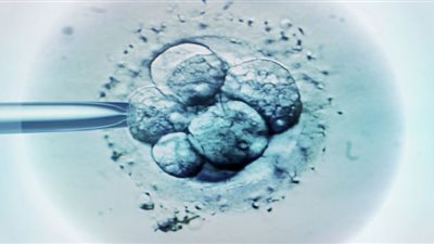 علاجات الخصوبة ترتبط بارتفاع مخاطر القلب لدى النساء