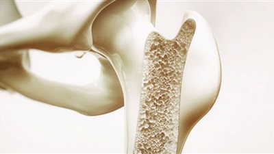 عارض صباحي ينذرك بالإصابة بهشاشة العظام