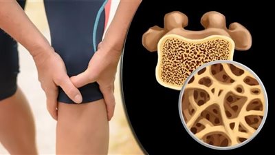 عارض في الصباح يدل على إصابتك بهشاشة في العظام