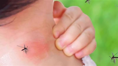 4 أعشاب طبيعية تقضي على الحشرات بشكل فعال