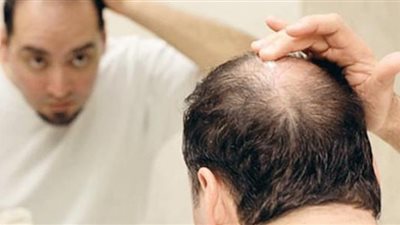 مشروبات وراء تساقط الشعر لدى الرجال.. دراسة توضح