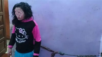 شابة مصرية تعيش مُكبلة بالقيود لأكثر من ١٠ أعوام .. القصة الكاملة