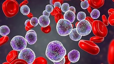 باحثون يتوصلون لعلاج سرطان الدم بالجينات