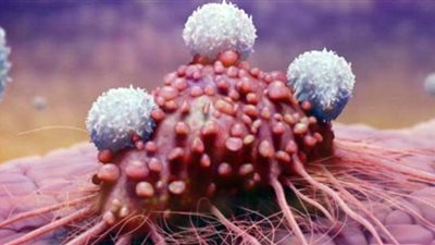 أعراض تدل على إصابتك بمرض خطير