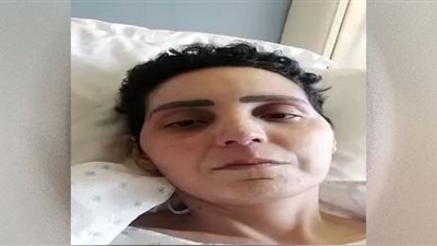 صرخات مصابة بالسرطان تهز السوشيال ميديا.. 