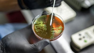 الصحة العالمية تحدد قائمة جديدة لمسببات الأمراض المقبلة