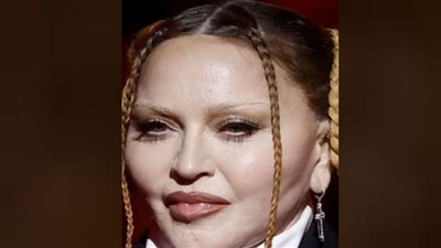 ملامح مادونا تصدم جمهورها في حفل الـ Grammy| تغيرت 180 درجة