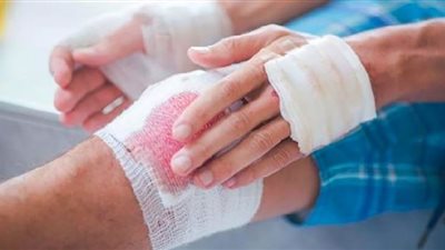 ابتكار لاصقة طبية لحالات النزف غير القابل للانضغاط