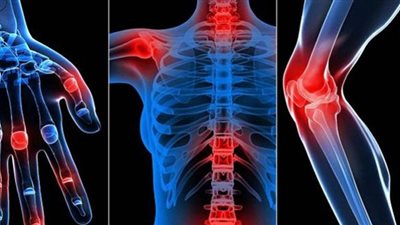 كيف تخفف آلام المفاصل في فصل الشتاء