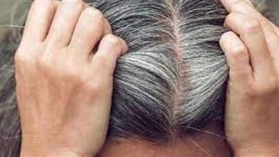 ظهور الشيب في سن مبكرة قد يدل على أمراض خطيرة