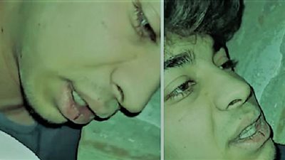 زلزال تركيا.. مراهق يستحوذ على قلوب أمة بفيديو وداع من تحت الأنقاض