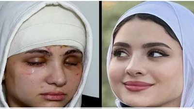 تفاصيل إصابة البلوجر سارة محمد بالعمى وتعرضها لأزمة نفسية (فيديو)