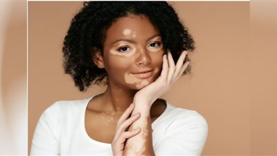 علاقة الأسماك بالأمراض الجلدية وطرق علاجها