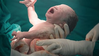 انخفاض معدلات الولادة القيصرية بمستشفيات وزارة الصحة لـ 61%