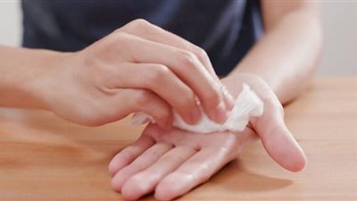 تعرق اليدين.. مرض يكشف أسباب خطيرة