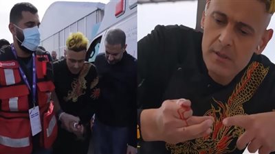 ثعبان يهدد حياة رامز جلال.. لدغة سامة على الهواء | شاهد