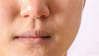 أطعمة تحافظ على نضارة البشرة في رمضان