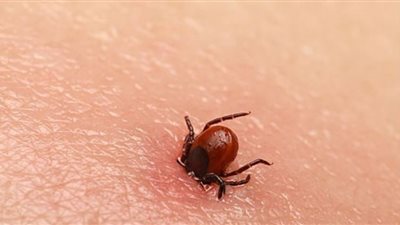 حشرة القراد تنقل فيروس قاتل في بريطانيا