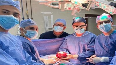 جراحة نادرة جدًا لورم بالصدر بمستشفيات جامعة بني سويف