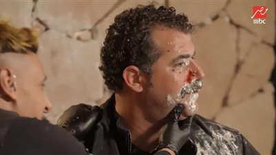 محمود حافظ يتعرض لإصابة خطيرة في غسالة رامز جلال.. شاهد