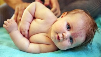 تحذير.. علامة حمراء تظهر بجسم الأطفال تُنذر بمرض يسبب الوفاة