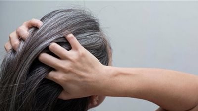 الأسباب الرئيسية لشيب الشعر