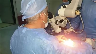 إجراء 12 عملية زراعة قوقعة للأطفال خلال 24 ساعة بسوهاج