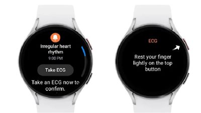Galaxy Watch تُنبهك في حالة عدم انتظام ضربات القلب