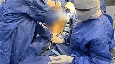 إجراء 8 عمليات تغيير مفصل ركبة بمستشفى الغردقة العام