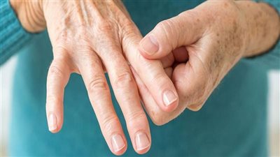 التمارين الرياضية تلعب دورا مهما في إدارة التهاب المفاصل