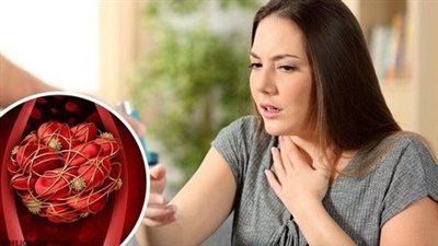 أعراض صامتة تحدث قبل تجلط الدم بشكل مفاجئ.. أطباء يحذرون من تجاهلها