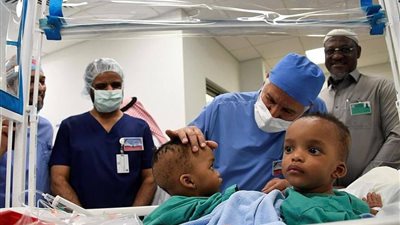 قصة التوأم الملتصق 