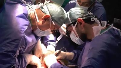 انتصار السيدات على الرجال في معركة التبرع بالكبد.. فيديو
