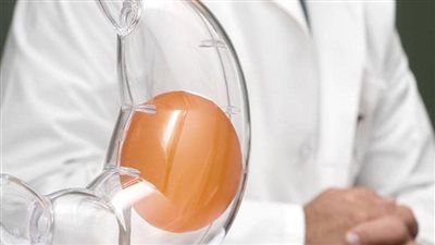 جراحات فقدان الوزن تسبب هشاشة العظام ودراسة تفجر مفاجأة