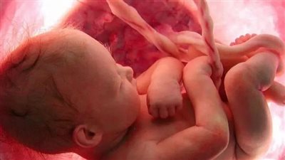 جراحة ناجحة لمخ جنين داخل رحم أمه (شاهد) 