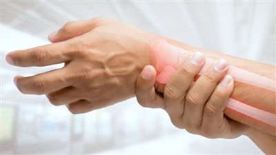 أولى علامات هشاشة العظام عند الرجال والنساء 