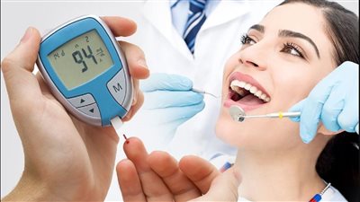 6 علامات خطيرة تظهر في الفم تنذرك بالإصابة بمرض السكر
