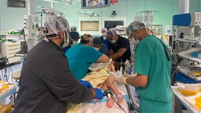 التوأم السيامي السوري.. تفاصيل 7 ساعات في غرفة العمليات