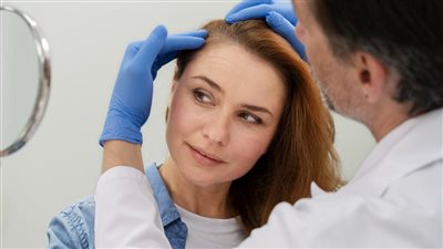 مفاجأة.. نقص الحديد يسبب الصلع عند النساء