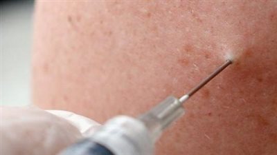 أنواع التهاب السحايا.. الفيروسي والمزمن أبرزها