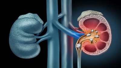 3 نصائح للمساعدة في الحفاظ على صحة الكلى