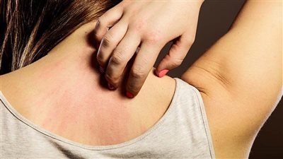 للنساء.. انقطاع الطمث يسبب حكة في الجلد