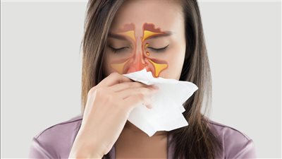 احتقان الأنف.. لماذا يحدث وكيف نخفف حدته؟