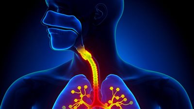 أنواع التهاب الشعب الهوائية.. من الحاد إلى المزمن
