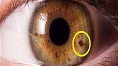 وظيفة الدماغ تكشفها حدقة العين.. دراسة تكشف التفاصيل 