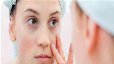 طبيبة غدد صماء تحدد أسباب التورم في الصباح