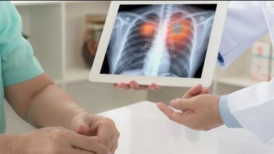 مسببات شائعة تؤدي للإصابة بالربو.. الحيوانات الأليفة واحدة منها 