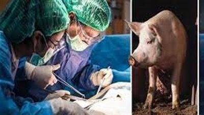 نجاح زراعة كلية خنزير في جسد إنسان