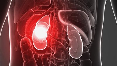 أشخاص معرضين للإصابة بالفشل الكلوي.. السمنة أبرزهم 