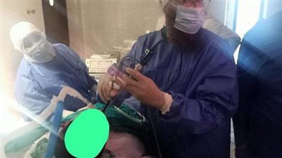 تفعيل وحدة مناظير الأنف والجيوب الأنفية بمستشفى ههيا